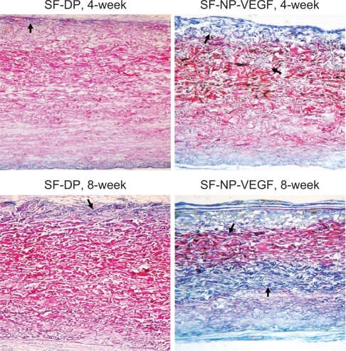 Figure 9 Herovici staining of collagen fibrils. Staining showed extracellular matrix components of scaffolds at 4 and 8 weeks implantation, original magnification × 200.Notes: Red indicates the mature collagen fibrils and blue indicates new collagen fibrils. The arrows indicate positive staining of new collagen fibrils.Abbreviations: DP, decellularized scaffolds; NP, nanoparticle; SF, scaffolds; VEGF, vascular endothelial growth factor