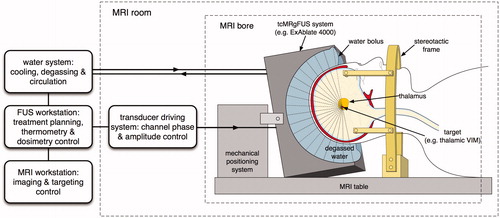 Figure 3. Schematic diagram of a tcFUS treatment with a phased array transducer like the ExAblate® 4000. The patient’s head is fully shaved, fixed to the table with a stereotactic frame and positioned in the helmet-like cavity of the transducer, which is filled with circulating, degassed water for scalp cooling and held back with a flexible membrane seal. The entire system is MR-compatible and integrated into a standard MR system.