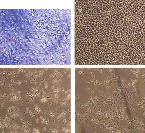 Figure 1. Phase contrast micrographs of MCF-7 cell treated with (A) vehicle (DMSO; control), (B) SLN (60 µg/mL) dispersed in DMSO, (C) TAM (12 µg/mL) dissolved in DMSO and (D) TAM-loaded SLN (12 µg/mL) dispersed in DMSO (magnification ×10).