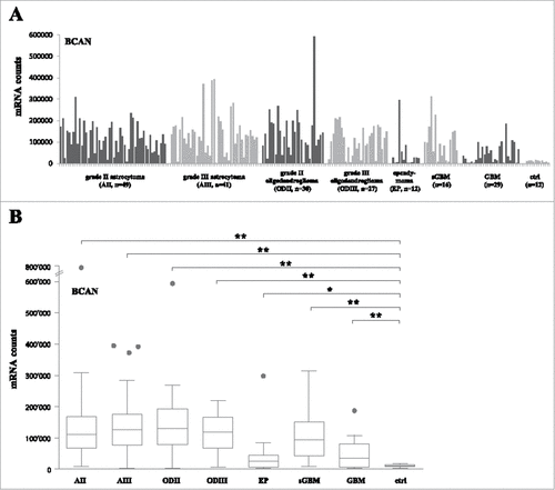 Figure 1. BCAN RNA expression on grade II, III astrocytoma, oligodendroglioma and ependymoma samples. (A) RNA counts using the Nanostring technology for the BCAN gene. Tumor samples are grouped by type and non-tumor control samples (8 epilepsy samples, 2 normal brains, 2 commercial RNAs) are shown on the right (ctrl). sGBM: secondary GBM. (B) Box plots analysis of expression of the BCAN gene on the different tumor groups showing the median, lower quartile (25th percentile) and upper quartile (75th percentile). The bars indicate the lower adjacent value and the upper adjacent value. Points indicate outliers. AII: grade II astrocytoma, AIII: grade III astrocytoma, ODII: grade II oligodendroglioma, ODIII: grade III oligodendroglioma, EP: ependymoma, sGBM: secondary GBM, ctrl: non-tumor samples. ##: p < 0.01, #: p < 0.05.