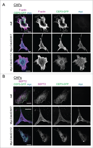 Figure 4. Modulating the activity of Cdc42 in CAFs affects Cdc42EP3 localization and septin and F-actin organization. (A) Panels show GFP (green), F-actin (magenta) and myc (blue) staining of cancer-associated fibroblasts (CAFs) stably expressing Cdc42EP3-GFP following transfection with empty vector, myc-Cdc42-N17 or myc-Cdc42-V12. The grayscale panels show individual channels as indicated. Scale bars, 25 μm. (B) Panels show GFP (green), SEPT2 (magenta) and myc (blue) staining of cancer-associated fibroblasts (CAFs) stably expressing Cdc42EP3-GFP following transfection with empty vector, myc-Cdc42-N17 or myc-Cdc42-V12. The grayscale panels show individual channels as indicated. Scale bars, 25 μm.