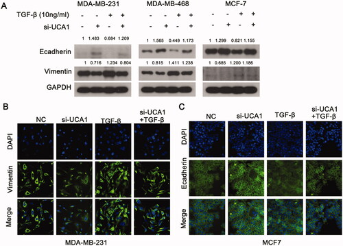 Figure 5. UCA1 modulates TGF-β-induced EMT. (A) Western blotting was used to analyze the expression of E-cadherin and vimentin in MDA-MB-231 and MCF7 cells following TGF-β stimulation for 24 h. (B) The level of vimentin expression was higher in the MDA-MB-231 siRNA group compared with the negative control cells following TGF-β stimulation for 24 h. (C) The expression of E-cadherin was higher in the MCF-7 siRNA group compared to the negative control cells following TGF-β stimulation for 24 h.