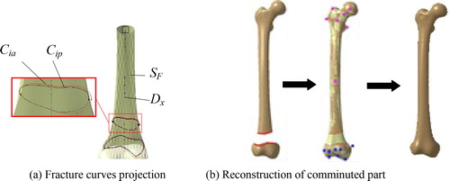 Figure 6. Construction of individual intact restored fracture model.