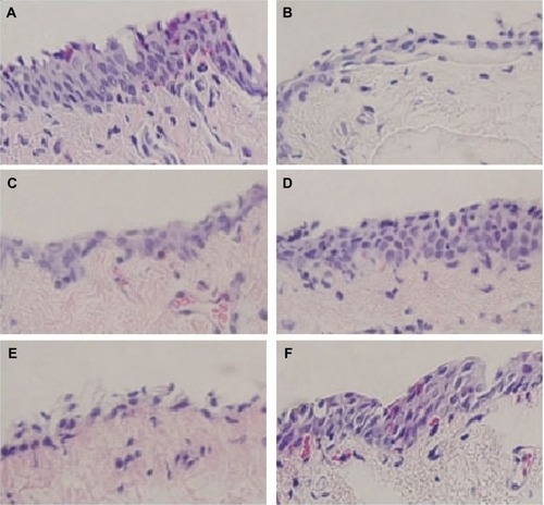 Figure 4 Images of histologic sections from the rabbit conjunctiva stained with H&E.Notes: (A) Administration of normal saline only; (B) administration of 1% atropine sulfate solution only; (C) AS + NS administration in group 1; (D) AS + O7 administration in group 1; (E) AS + NS administration in group 3; (F) AS + Restasis administration in group 3. Goblet cells are stained purple and located in the superficial epithelium. Epithelia in (B), (C), and (E) were thinned with loss of goblet cells. Goblet-cell morphology in (D) was relatively well formed. Magnification 40×. All solutions administered at 50 μL.Abbreviations: AS, atropine sulfate (1% solution); H&E, hematoxylin and eosin; NS, normal saline.