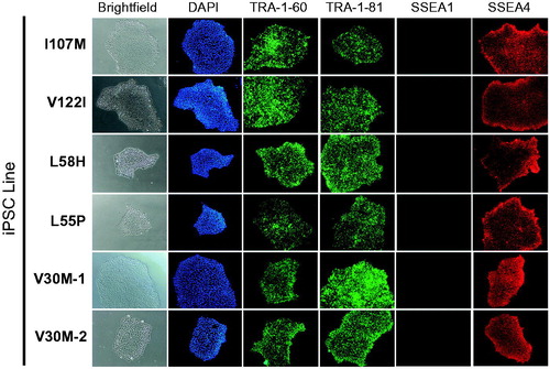 Figure 1. Patient-specific iPSCs express hallmark pluripotency markers. Five days after passaging, iPSC colonies from all representative lines express hallmark pluripotency cell surface markers TRA-1–60, TRA-1–81 and SSEA4. Colonies do not express murine pluripotent stem cell surface marker SSEA1. Nuclei stain positive with DAPI. Images taken at 10#x0FBE; magnification.