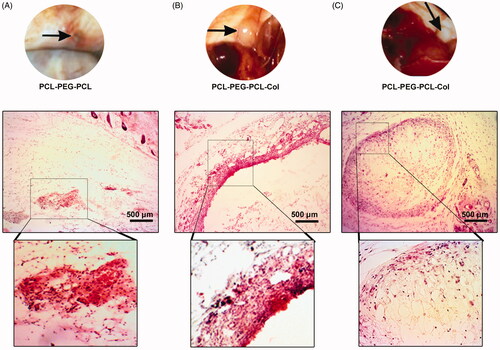 Figure 7. Gross and histological examination of the transplantation site after 14 days (A–C). In group PCL-PEG-PCL, the transplant mass was considerably biodegraded while PCL-PEG-PCL-Col and PCL-PEG-PCL-Col/nHA exhibited a slow biodegradation rate. Bright-field imaging showed the lack of PCL-PEG-PCL substrate beneath the epidermis while remnants of PCL-PEG-PCL-Col and PCL-PEG-PCL-Col/nHA were surrounded by fibrotic tissue. These data showed the stability of PCL-PEG-PCL-Col and PCL-PEG-PCL-Col/nHA hydrogels in in vivo conditions after 14 days.