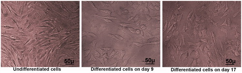 Figure 5. Morphological characterization of endothelial-like cells induced from hEnSCs. Phase-contrast images of hEnSCs before and after the treatment in TCP group. During the inductions, the morphology of cells changed from a spindle cell shape to a polygonal-shaped endothelial cell on day 17.