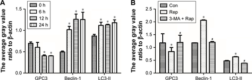 Figure S1 (A) Autophagy induced by starvation reduced GPC3 protein level. Expression of GPC3 in HepG2 cells was decreased in serum Starv, and expression of Beclin-1 and LC3 was significantly increased. *p<0.05. (B) Autophagy reduced GPC3 protein level. Expression of GPC3 in HepG2 cells was significantly decreased under the stimulation of 100 nM Rap, while 3-MA rescued the reduction induced by Rap. *p<0.05 vs control. #p<0.05 vs Rap.
