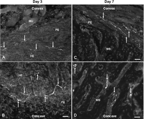 Figure 3. Fluorescence photomicrographs showing site-specific occurrence of NPY fibers on the convex (A and C) and concave (B and D) sides of angulation fractures at days 3 (A and B) and 7 (C and D) after fracture. 20× objective. Bar represents 50 μm. Arrows show NPY fibers. HE: hematoma; MU: muscle; PE: periosteum; WB: woven bone.