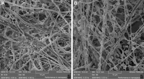 Figure 1 SEM visualization of platelet adhesion on PCL fibers.Notes: Platelets were partially activated and formed a fibrin net 24 h after adhesion (A). Platelets were visibly adhered on fibers even after 14 days of the experiment (B).Abbreviations: SEM, scanning electron microscope; PCL, poly-ε-caprolactone.