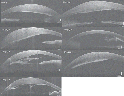 Figure 2. OCT imaging at one month showing retrocorneal membrane/fibrosis in all minipigs. Corneal edema was present in association with the membrane in all minipigs except for minipig 4, where retrocorneal membrane formation was confined to the area around the main incision. In minipigs 6 and 8 the membrane formed a web-like structure in the anterior chamber with adhesion to iris and lens