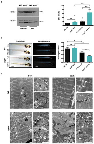 Figure 4. Starvation response of zebrafish epg5 mutants. (a) Representative western blot for Lc3 in 8-dpf WT and epg5-/- larvae under fed and fasting conditions (left panel), and densitometric analysis of band intensities (right panel). β-actin was used as a control for protein loading. Lc3-II expression was higher in homozygous mutants with respect to WT and, upon starvation, epg5-/- mutant larvae exhibited a significantly higher increase of Lc3-II levels than the corresponding WT larvae. Statistical significance was determined by one tail t-test. Data are presented as mean ± SEM and were generated from 3 biological replicates with pools of 12 larvae (*P, < 0.05; **, P < 0.01; ***, P < 0.001). (b). Light microscopy analysis of muscle birefringence in 8-dpf WT and epg5-/- larvae under fed conditions and following two-day starvation (left panels), and quantification of muscle birefringence (right panel). Bright field images of WT and epg5-/- larvae are shown for reference. A global decrease of muscle birefringence is detected in fasted WT and epg5-/- larvae, but two-day starvation led to a significantly higher decrease of muscle birefringence in epg5-/- larvae when compared to controls, consistently with a myopathic phenotype. Quantification of birefringence was calculated as described in the Methods section. Statistical significance was determined by Student’s t-test. Data are presented as mean ± SEM and were generated from 3 different experiments, each containing 10 larvae per genotype and treatment condition (*, P < 0.05; **, P < 0.01; ****, P < 0.0001). Scale bar: 1 mm. (c) Transmission electron microscopy analysis of 8-dpf WT and epg5-/- larvae (left panels) and adults (right panels) subjected to food starvation for 2 d. In agreement with a defective regulation of autophagy, starved epg5-/- mutant larvae and adults display an accumulation of autophagosomes (AF) and membrane-like structures (ml). In contrast, starved WT larvae and adults display enlarged mitochondria (M) and rare autophagosomes (AF). Ultrastructural analysis was performed with 4–5 animals per genotype. Scale bar: 1 µm.