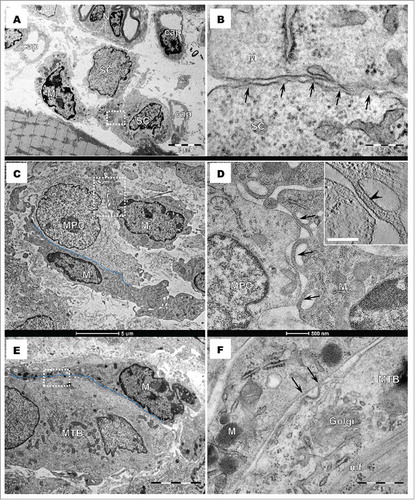 Figure 2. Transmission electron microscopy of gastrocnemius muscle, 5 d after injury. (A). Satellite cell (SC) migrates away from the myofiber and establishes close contacts (rectangular marked area) with a macrophage (M). N – nerve, cap – capillary. (B). Higher magnification of marked area in A. shows the apposition of SC and M cell membranes Direct contacts between the 2 cell membranes are visible (arrows). (C). A myogenic precursor cell (MPC) establishes 2 different types of contacts with macrophages (M): a planar contact (dotted line) extending over 10 µm and point contacts (rectangular marked area, enlarged in D). (D). Convex pseudopodial extensions (arrows) of the macrophage (Mb), containing thin filaments (arrowhead in the inset), fit MPC cytoplasmic protrusions. (E). A planar contact (blue dotted line) is visible between a macrophage (M) and a myotube (MTB), and extends over 15 μm. (F). Higher magnification of rectangular marked area in E. reveals details of the planar contact between M and MTB. Arrows indicate point contacts on both sides of a coated pit which contains a weak electron-dense material. Golgi and myofilaments (mf) are visible in the cytoplasm of the MTB.