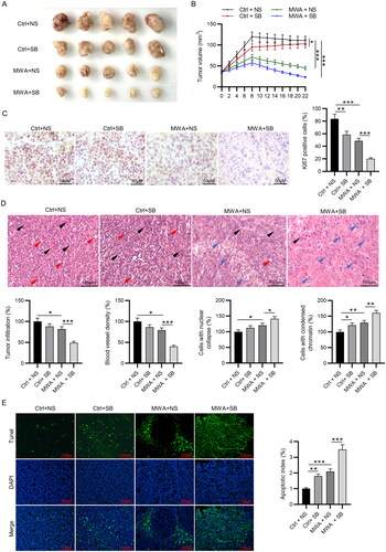 Figure 4. MWA combined with TGF-β1 inhibitor inhibits tumor growth and histopathological changes in vivo. (A) The gross manifestation of tumors on day 22 after MWA. (B) Changes in tumor volume were recorded at the indicated time points. (C) Immunohistochemistry staining was used to detect the expression of Ki67. (D) Histopathological changes of tumor tissues were examined by hematoxylin and eosin staining, and quantification of tumor infiltration area, blood vessel density, cells with nuclear collapse and cells with condensed chromatin was conducted. Black and red arrows represent blood vessels and tumor infiltration, respectively. Blue arrow represents nuclear deformation and chromatin condensation. (E) TUNEL staining was performed to assess tumor apoptosis. Data were analyzed by one way analysis of variance followed by Tukey’s post hoc analysis and expressed as mean ± SD of three independent experiments. N = 5 mice each group. *p < .05, **p < .01, ***p < .001.