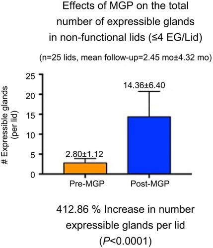 Figure 5 Our study results as seen in this histogram show the increase in numbers of expressible glands per lid after probing. All 25 lids showed four or less expressible glands per lid pre-probing with an average of 2.80 while at a mean follow up of 2.45 months showed 14.36 expressible glands per lid, an increase of 412%. Maskin, unpublished data, 2018.