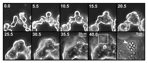 Figure 1. Time lapse studies monitoring lipid droplet formation in dispersed islet cells. Phase contrast digital images of dispersed islet cells treated with 25 mM glucose and 500 μM FFAs (oleate:palmitate = 1:1v/v) were acquired at 30 min intervals for 40 hours using a 20× objective. Representative images at the indicated time (h) are shown. An enlarged image indicated by the white arrow (far right panel) demonstrates that lipid droplets were uniform in size. Images were rescaled using Adobe Photoshop software. Results are representative of three independent experiments.