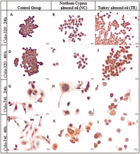 Figure 8. Immunoreactivity of LGR5 in Colo-320 (A–F) and Colo-741 cells (G–L) for 24 (A–C, G–I) or 48 h (D–F, J–L) culture with standard culture conditions (A, D, G, J) or Northern Cyprus (B, E, H, K) or Turkey (C, F, I, L) almond oils. Scale Bars = 20 μm.