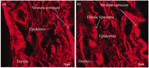 Figure 9. CLSM photomicrographs of cross-sections of hairless viable rat skin incubated on Franz diffusion cell with elastic liposome containing probe RR for 24 h, sectioned 0.5 μm below the cutting surface: (a) skin treated with EL3-S80-RR (0.5% w/v) and (b) skin treated with drug loaded EL3-S80-RR. Lens with magnification of 40× (immersion objective); excitation: 488 nm; emission: 560 nm.