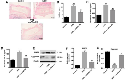 Figure 7 Overexpression of hsa_circ_0059955 ameliorated IVDD in rats in vivo. (A) Representative HE staining of NP tissues and fibrous annulus tissues. Scale bar, 200 μm. (B) The histological grades of control, IVDD and IVDD + shRNA1 groups. (C, D) ELISA assay was applied to detect the levels of TNF-α and IL-1β in the serum of rats. (E–G) Expressions of MMP2 and aggrecan in the disc were detected with Western blotting. The relative expressions of MMP2 and aggrecan were quantified via normalization to β-actin. **P < 0.01, compared with the blank group; ##P < 0.01, compared with the IVDD group.