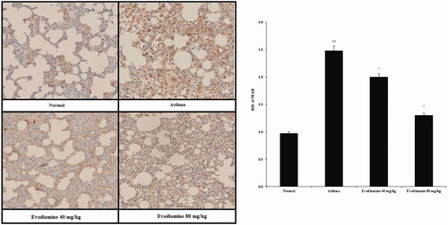 Figure 5. Immunohistochemical analyses of the expression of NF-κB protein in the lung tissue of asthmatic rats. Values are means ± SD (n = 8); @@p < 0.01 compared to the normal group; **p < 0.01 compared to the asthma group.