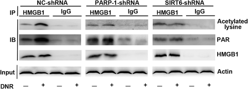 Figure 4. The SIRT6-PARP1 complex was related to the polyADP-ribosylation and acetylation of HMGB1. Jurkat cells were transfected with control, PARP1 or SIRT6 shRNA with or without DNR (0.4 μM) treatment for 24 hours. The cell lysates were pulled down with an HMGB1 antibody and immunoblotted with anti-acetylated lysine, anti-PARylation or HMGB1 antibodies. β-actin was used as a loading control.