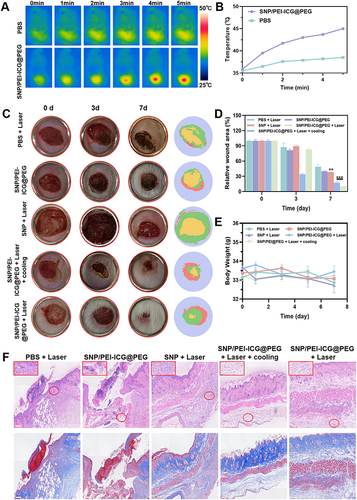 Figure 7 (A) Thermal imaging of mice after laser irradiation. (B) Corresponding temperature curve. (C) Treatment period (0, 3, 7 days), Camera images and ImageJ rendering of Staphylococcus aureus infected wounds in different treatment groups (PBS + Laser, SNP/PEI-ICG@PEG, SNP + Laser, SNP/PEI-ICG@PEG + Laser + cooling, SNP/PEI-ICG@PEG + Laser) Wound healing diagram. (D) The statistical map of wound healing rates. (mean ± SD, n=4; **P < 0.01, ***P < 0.001) (E) Weight changes during treatment (days 0, 1, 3, 5, 7; mean ± SD, n=4). (F) H&E and Masson staining of the wound tissues, (bar=100 μm).