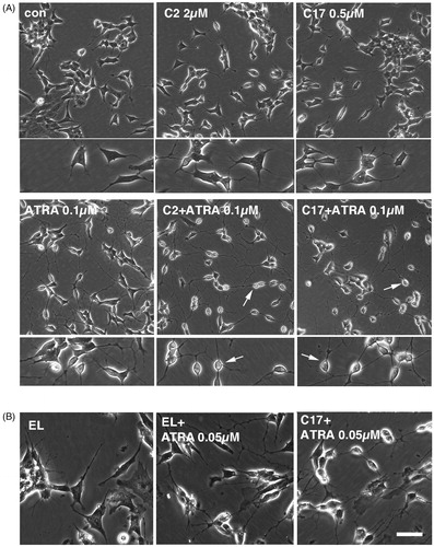 Figure 4. (A) SK-N-SH cells were treated for 72 h with 0.1 µM ATRA, 2 µM C2 liposomes (C2), 0.5 µM C17 liposomes (C17) and combinations thereof. Phase contrast images show that liposomal RAMBAs in combination with ATRA generated highly rounded, neuron-like cells (arrows); 2× enlargements are shown below the main panels. (B) SK-N-SH cells treated for 72 h with empty liposomes (EL) with or without 0.05 µM ATRA, and 0.5 µM C17 liposomes plus 0.05 µM ATRA. Scale bar = 50 µm for rows 2, 4 and 5; 100 µM for rows 1 and 3. Maximal, hypothetical concentrations of the RAMBAs are indicated.