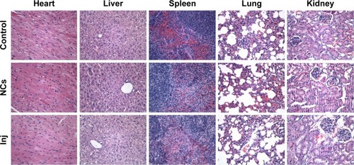 Figure 10 Histological analysis of the representative organs for control, 10-HCPT nanocrystals, and 10-HCPT injections groups (magnification, 400×).Abbreviations: 10-HCPT, 10-hydroxycamptothecin; Inj, injections; NCs, nanocrystals.