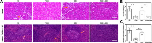 Figure 6. The ability to alleviate DOX-induced splenocardiac toxicity. (A) H&E staining image of hearts and spleens (white pulp) dissected fromtumor-bearing mice after 14 days treatments, scale bar = 50 μm. The statistical analysis of myocardial injury (B) and relative atrophy of white pulp (C) obtained by two blinded pathologists under microscope. The necrotic myocardial cells and white pulp were pointed by arrows. Data are expressed as mean ± SD (n = 7), ** represented p < 0.01.