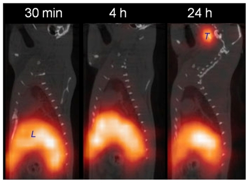 Figure 4 CT-SPECT images of iodine-125 labeled silver nanoparticles in rats at different time points after intravenous administration. Sagittal slices are shown. Injected dosage: 20 μCi at a specific activity 0.6 μCi/μg. Positions of the liver (L) and thyroid (T) are indicated.