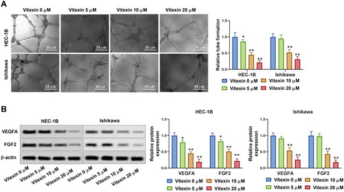 Figure 3. Vitexin suppresses endometrial cancer cell angiogenesis in vitro. HEC-1B and Ishikawa cells were treated with vitexin (0, 5, 10, 20 μM) for 24 h. (A) Angiogenesis ability of HEC-1B and Ishikawa cells was evaluated using the tube formation assay. (B) The protein levels of VEGFA and FGF2 were measured using Western blots. *p < 0.05; **p < 0.01 vs. vitexin 0 μM group.