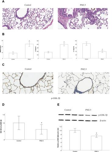 Figure 1 PM2.5 induced inflammatory changes and reduced the expression of p-GSK-3β in the lungs of mice.