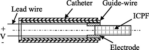 Figure 15. Basic structure of the micro catheter [Citation11]. Reprinted with the permission, from [Citation11] © 1995 IEEE.