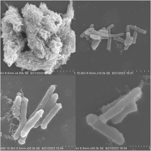 Figure 3 Morphology of Tsukamurella tyrosinosolvens strains under electron microscope: 0.5–1μm in size, nonflagellar, noncapsular irregular bacilli.