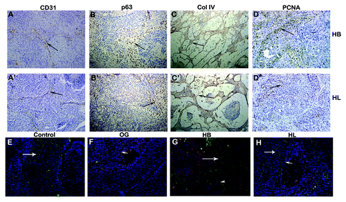 Figure 5. Immunohistochemical analysis of 35 d MCF10ADCIS.com xenografts from HB and HL fed mice. (A–D): HB fed; A’-D’: HL fed. (A,A’): CD31; (B,B’): p63; (C,C’): Collagen IV; (D,D’): PCNA. Brown color represents positive staining. (B,D): 200 × ; (A,C): 100 × . (E–H): Cleavage of galectin-3 in a 35 d xenograft. €: water fed; (F): OG fed,(G): HB fed, (H): HL fed. Red and yellow color indicates intact galectin-3 using mAb (arrowhead); Green color indicates cleaved galectin-3 using pAb (arrows). DAPI was used for nuclear staining. 200 ×