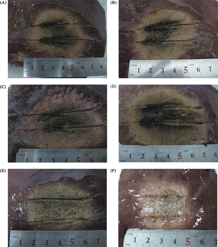 Figure 4. Photograph shows gross specimen of porcine liver tissue treated with MW and RF ablation in ex vivo study, which was produced by using two internally cooled probes with intervals of 2 cm for a duration of 10 min. The charring is arrow-shaped. (A) MW ablation with two probes at 50 W. (B) MW ablation with two probes at 60 W. (C) MW ablation with two probes at 70 W. (D) MW ablation with two probes at 80 W. (E) multipolar RF ablation with two T30 probes and rated power 60 W. (F) multipolar RF ablation with two T40 probes and rated power 80 W.