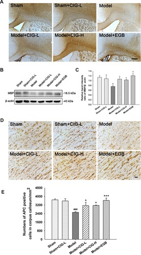 Figure 4 Effects of CIG on MBP expression and the number of mature oligodendrocytes in the corpus callosum of MCAO rats.