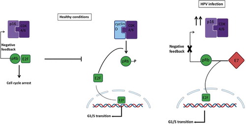 Figure 4. Mechanism of regulation mediated by p16INK4A during healthy conditions and HPV infection. In healthy non-HPV-infected cells (left), p16INK4A (p16) serves as a fundamental regulator of the cell cycle induction. When a cell has to go through G1/S transition, the cyclin-dependent kinases 4 and 6 (CDK4/6) forms a complex with cyclin D. The entire complex phosphorylates the retinoblastoma protein (pRb), which, in normal conditions, binds the transcription factor E2F. The phosphorylation mediated by the CDK4/6-cyclinD complex provokes E2F release, which promotes the transcription of those essential genes for the G1/S transition phase. At the same time, when the same healthy cell has to go towards cell cycle arrest, the regulatory protein p16 forms a complex with CDK4/6, preventing its binding to cyclin D and, hence, the transcription of E2F-correlated genes. However, in an HPV-infected cell (right), the viral protein E7 competes for the binding of pRb, and their linkage permits the release of E2F and the transcription of G1/S-genes. The expression of p16 will try to regulate the entire process, but the transcription factor release does not depend on CDK4/6-cyclinD phosphorylation; instead, it depends on E7 viral activity. Negative feedback mediated by pRb-E2F controls the expression of p16; hence, since this complex no longer exists, the loop is disrupted, and this will result in overexpression of p16 even if its regulatory activity is not accomplished
