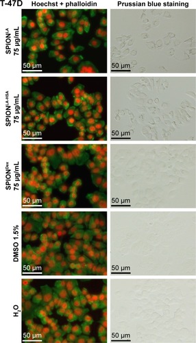 Figure 3 Images of the cellular particle load and cell morphology after SPION treatment.Notes: T-47D cells were incubated for 48 h with 75 µg/mL SPIONLA, SPIONLA-HSA and SPIONDex. Cells were imaged with a fluorescence microscope. Cells stained with Alexa Fluor 488 Phalloidin (green) and Hoechst 33342 (red) images are shown in the left column, Prussian blue stainings are shown in the right column.Abbreviations: SPION, superparamagnetic iron oxide nanoparticles; SPIONLA, lauric acid-coated SPIONs; SPIONLA-HSA, lauric acid- and human serum albumin-coated SPIONs; SPIONDex, dextran-coated SPIONs.