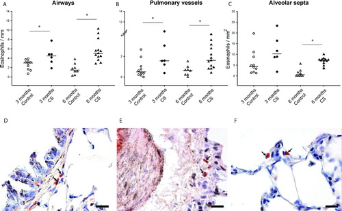 Figure 3.  Eosinophil infiltration in the lungs of guinea pigs. Individual count for eosinophils in the airways (A), pulmonary vessels (B) and alveolar septa (C) of controls and CS-exposed animals. Results are expressed as number of cells normalized by Pil in airways, Pim in vessels or square millimeter in alveolar septa. Horizontal bars represent median values. * p ≤ 0.05 CS-exposed vs. Control (Mann-Whitney rank sum test). Photomicrographs of an airway (D), a pulmonary vessel (E) and alveolar septa (F) of guinea pigs exposed to CS (Congo red stain. Scale bar, 20 mm). Arrows show infiltrating eosinophils.