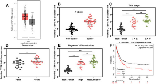 Figure 1 CTBP1-AS2 was highly expressed in GC and was associated with poor prognosis of patients. (A) CTBP1-AS2 expression in GC samples was analyzed using GEPIA database. (B) qRT-PCR was performed for detecting CTBP1-AS2 expression in GC tissues from 37 patients. (C–E) The relationships between CTBP1-AS2 expression level and patient’s TNM stage (C), tumor size (D) and degree of differentiation (E). (F) Kaplan–Meier method was employed for analyzing the relationship between CTBP1-AS2 expression and post-progression survival time of GC patients. *P < 0.05, **P < 0.01, and ***P < 0.001.