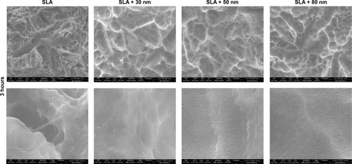 Figure 7 FE-SEM images of the morphology of MG63 cells cultured on different groups for 3 hours (upper panel 2,000×) and high magnification images (lower panel 25,000×) of the filopodia that firmly anchored to the surfaces of different groups.Notes: MG63 cells attached to the 10–30 μm pits generated by sandblasting. On the three micro/nanotextured surfaces, the cells show more filopodia extending from the leading edges with increasing nanotube diameters compared with the SLA group.Abbreviations: FE-SEM, field emission scanning electron microscopy; SLA, sandblasting with large grit and acid etching.