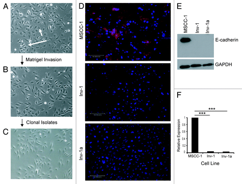 Figure 1. Isolation and characterization of E-cadherin expression in OSCC cell lines. (A-C) Cell lineage map of Inv-1a isolation. (A) MSCC-1harbor cells that form adhesive clusters (long arrow) and individual, spindle shaped cells (short arrow). (B) The majority of Inv-1 cells appear as individual, spindle shaped cells. (C) All Inv-1a cells are spindle shaped and appear as single cells. (D) Immunofluorescent staining of cells for E-cadherin (red) and dapi (blue). Only MSCC-1 cells show positive E-cadherin expression localized to the cell-cell junctions. Scale bars = 100 µm. (E) protein gel blot analysis of E-cadherin and GAPDH in protein extracts from MSCC-1, Inv-1, and Inv-1a. (F) qRT-PCR for E-cadherin mRNA. Data are compared with MSCC-1 and normalized to GAPDH. ***p < 0.00001.