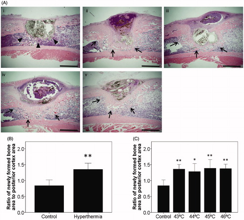 Figure 3. Histological findings at 2 weeks after implantation. (A) Representative sections at 2 weeks after implantation with H&E staining in the control group and all types of the hyperthermia group (43–46 °C) are shown. Sections of all hyperthermia groups revealed increased newly formed bone around the tibial defects (arrows) compared with the control group (arrowheads). Bars indicate 2 mm. (i) Control. (ii) Hyperthermia at 43 °C. (iii) Hyperthermia at 44 °C. (iv) Hyperthermia at 45 °C. (v) Hyperthermia at 46 °C. (original magnification ×20). (B) The histomorphometrical analyses used Image J software for quantification. Ratios of newly formed bone area were plotted on a graph. (C) Ratios of newly formed bone at each temperature (43–46 °C) and control were also plotted. Data are expressed as the mean ± SD. *p < 0.05, **p < 0.01.