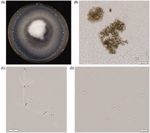 Figure 2. Cultural characteristics and morphological features of Verticillium dahliae. (A) Colony grown on PDA at 25 °C for 20 days. (B) Microsclerotium (Bar = 20 μm). (C) Mycelia and verticillate conidiophores of the isolate (Bar = 20 μm). (D) Conidia of the isolate (Bar = 20 μm).