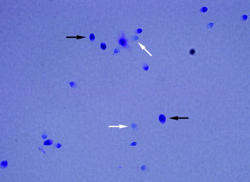 Figure 1.  Toluidine blue (TB) staining. Light blue sperm cell heads shown with white arrows were scored as normal integrity and those with purple (deep violet) heads shown with black arrows were scored as having damaged chromatin.