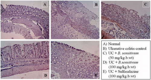 Figure 9. (A) Immunohistochemical localization of COX-2 in normal control; and (B) positively stained brown granules for COX-2 were significantly increased in both number and intensity in colonic tissue of acetic acid-treated rats. (C and D) B. sensitivum (50 or 100 mg/kg b wt) and (E) sulfasalazine (100 mg/kg b wt) treated reduced colonic COX-2 expression of acetic acid treated rats.