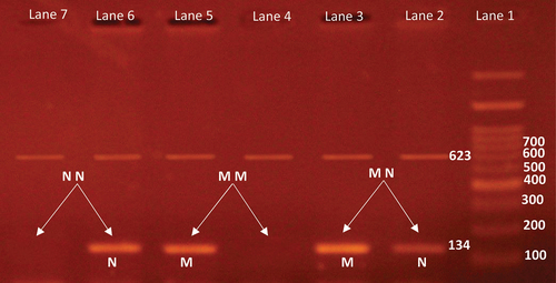 Figure 2. Agarose gel electrophoresis of BRAF(V600E) gene.