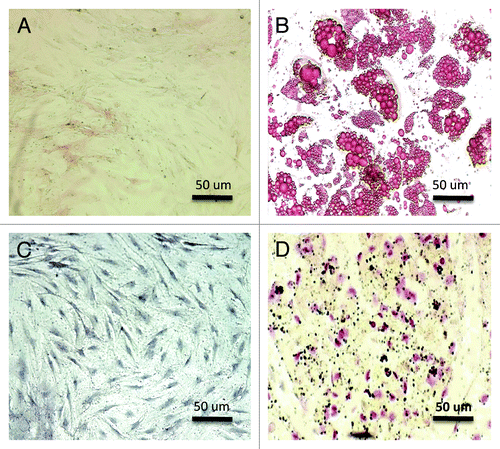 Figure 1. (A and D) The mesenquimal stem cells (ADSCs and MDSCs) appeared elliptical and fusiform before differentiation. (A) ADSCs before differentiation (200×). (B) Oil red O staining of ADSCs after differentiation demonstrating adipose vesicles (200×). (C) MDSCs before differentiation (200×). (D) Von Kossa staining of MDSCs after differentiation demonstrating calcium deposition (200×).