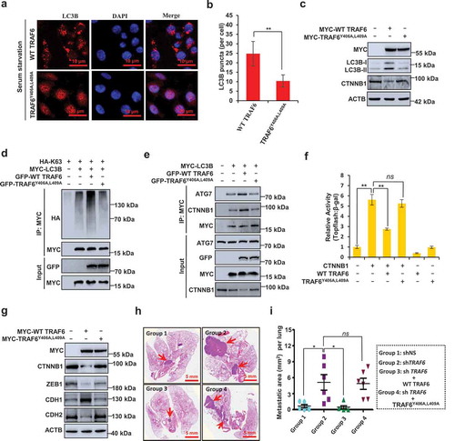 Figure 6. LIR motif of TRAF6 is required for its regulations of selective autophagic CTNNB1 degradation, EMT inhibition, and CRC metastasis. (a,b) Representative images (a) and quantification (b) of LC3B puncta in HCT116 cells stably transfected with MYC-TRAF6 or MYC-TRAF6Y406A,L409A during growth in normal medium without FBS. (c) Immunoblot detection of the indicated protein in HCT116 cells transfected with MYC-TRAF6 or MYC-TRAF6Y406A,L409A plasmid. (d) Mutation of the YISL motif in TRAF6 reduces K63-linked polyubiquitination of LC3B. Immunoprecipitation, and immunoblot of cell lysates from HEK293T cells expressing the indicated plasmids. (e) HCT116 cells were transfected with the indicated plasmids for 24 h, then the coimmunoprecipitation of endogenous ATG7 or CTNNB1 with MYC-LC3B were analyzed. (f) Luciferase reporter assay for measuring TOP-Flash reporter activity in HEK293T cells co-expressing TRAF6 or TRAF6Y406A,L409A and CTNNB1. (g) HCT116 cells were transfected with MYC-TRAF6 or MYC-TRAF6Y406A,L409A plasmid for 24 h, and the lysates were analyzed with the indicated antibodies. (h,i) Representative lung picture tissues are shown by HE staining (h), and the area of metastatic nodules in individual mice was calculated by Dmetrix software (i). Arrows indicate metastatic nodules (n = 6 for each group).